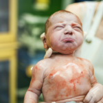 Which Type of Birth Injury Occurs Most Commonly?