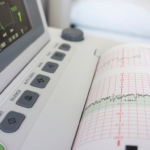 Understanding Improper Fetal Heart Monitoring