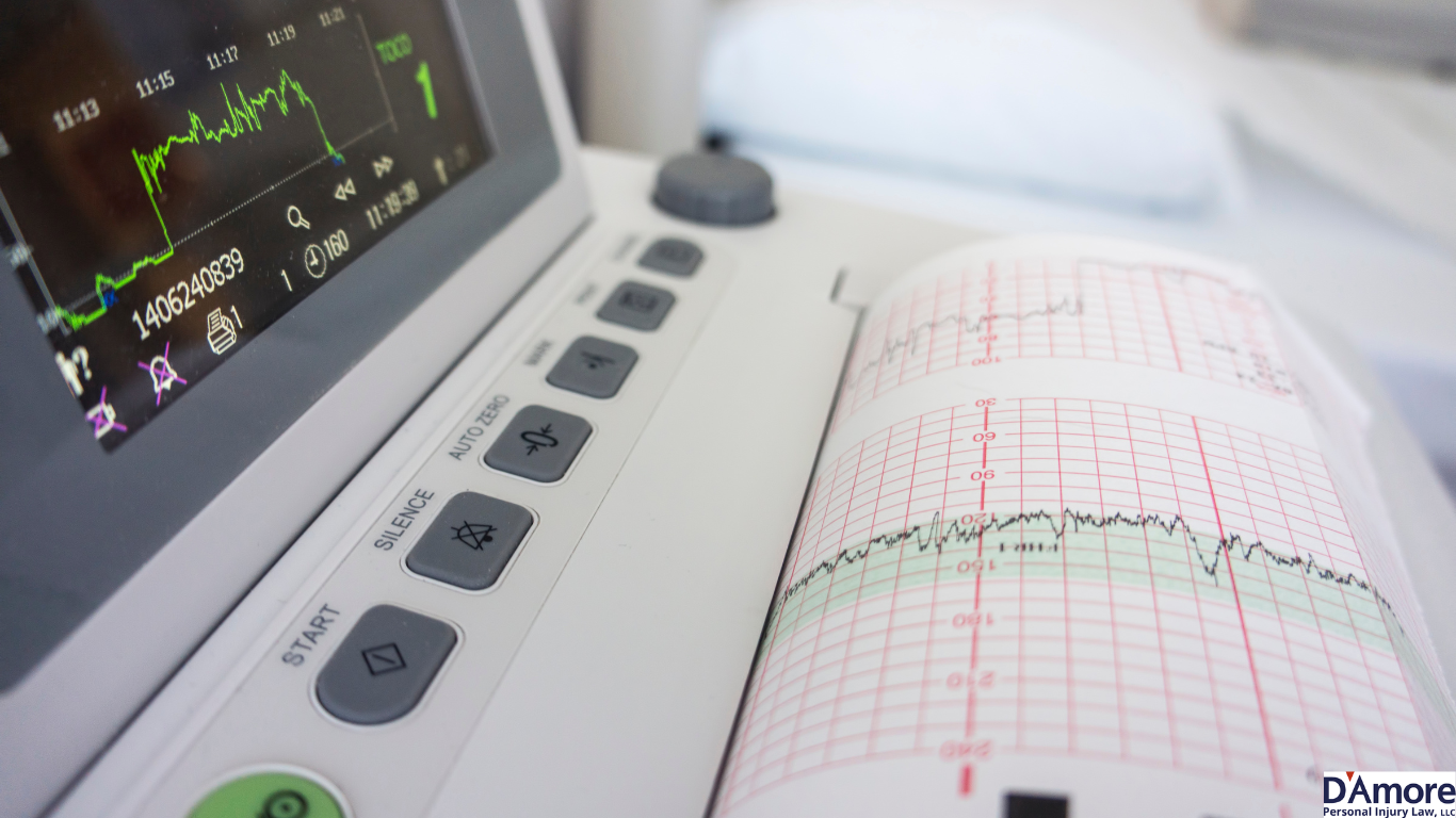 Understanding Improper Fetal Heart Monitoring